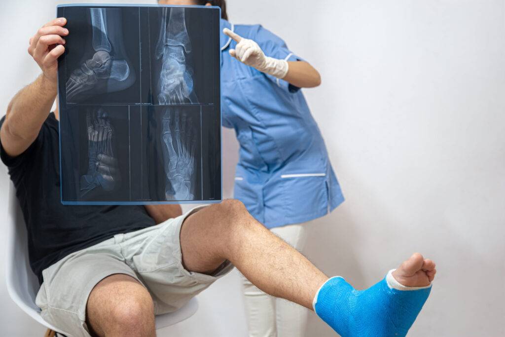 Nevada Bone Fractures Lawyer