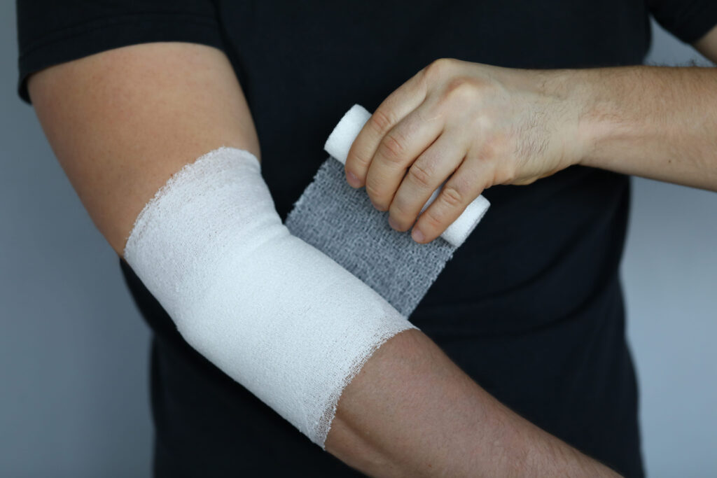 Nevada Burn Injuries Lawyer
